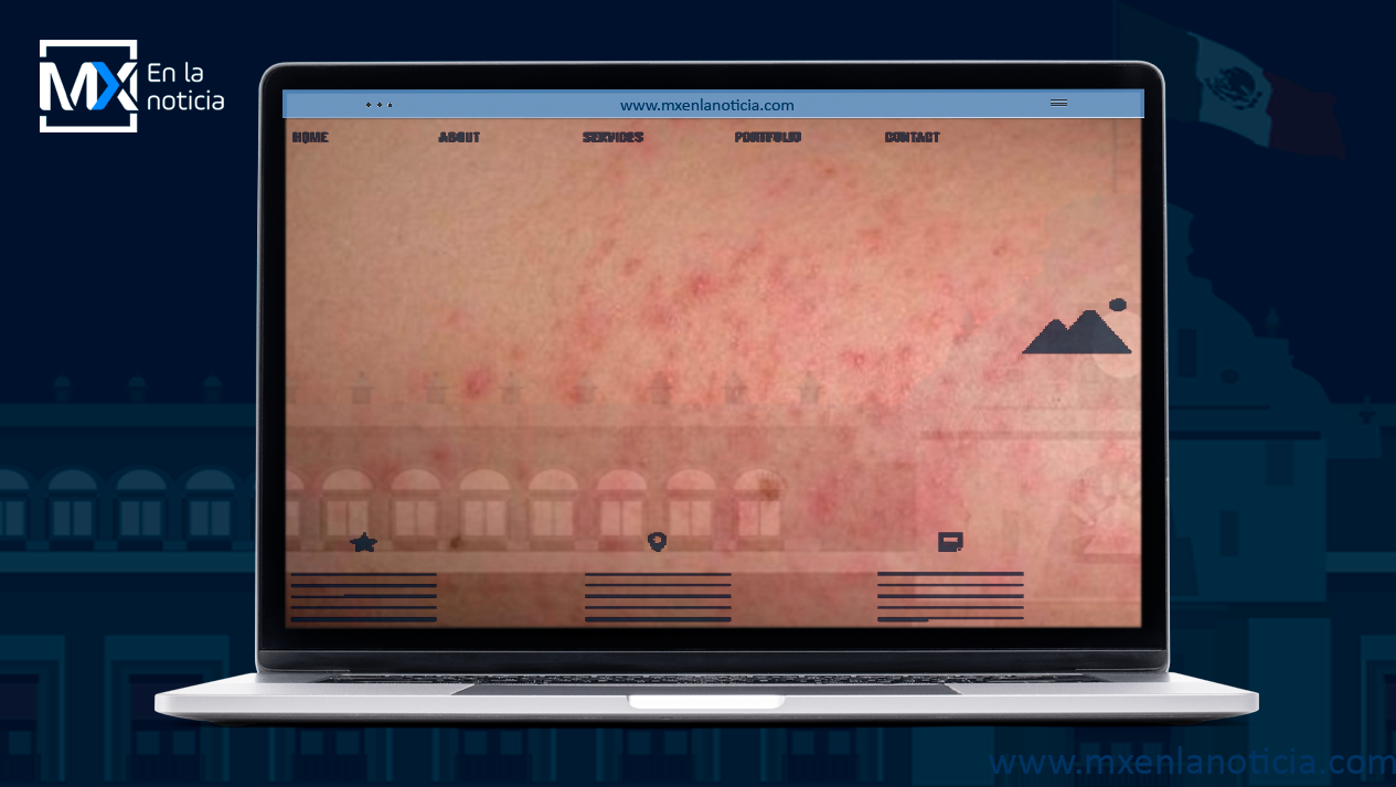 La valoración médica es relevante para cualquier tipo de dermatitis